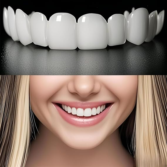 Carillas Dentales Estéticas 50% Descuento