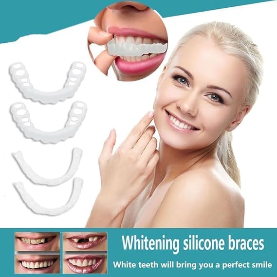 Carillas Dentales Estéticas 50% Descuento
