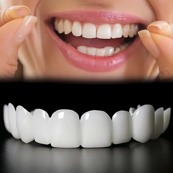 Carillas Dentales Estéticas 50% Descuento