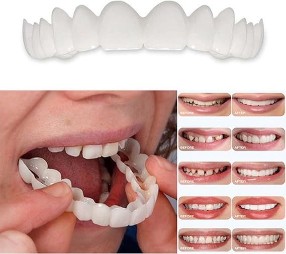 Carillas Dentales Estéticas 50% Descuento